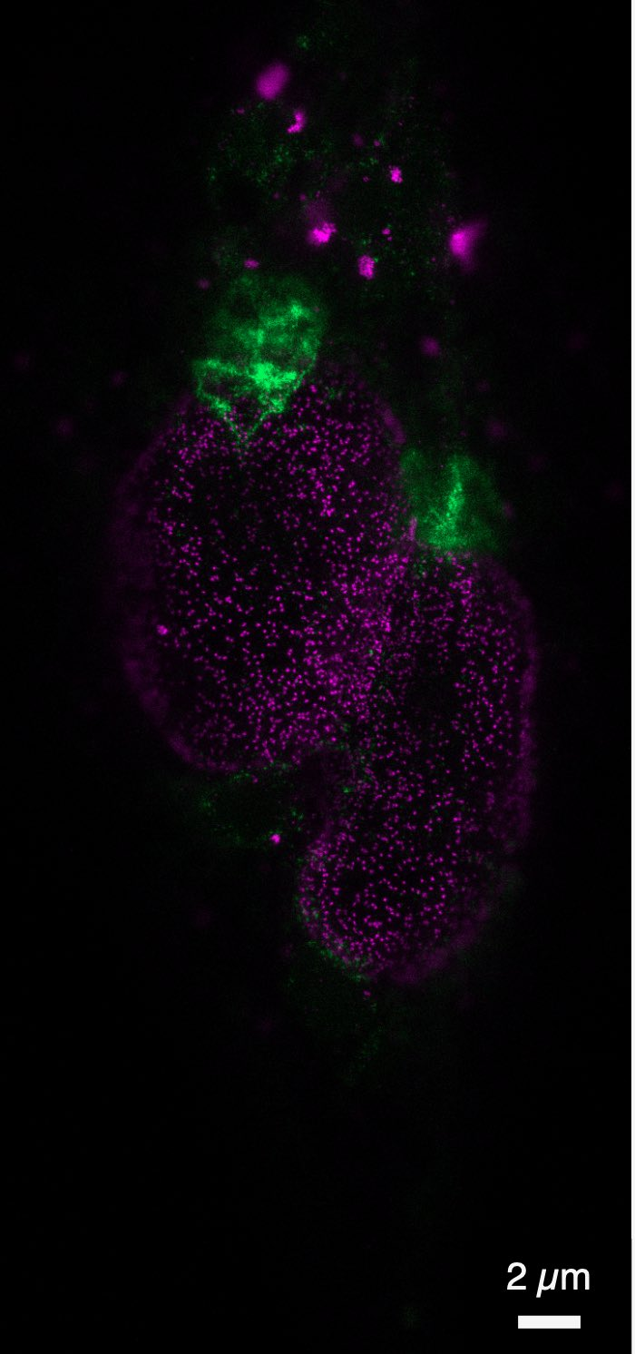 Beyond the Snapshot: Digitizing the Living Cell in Real Time